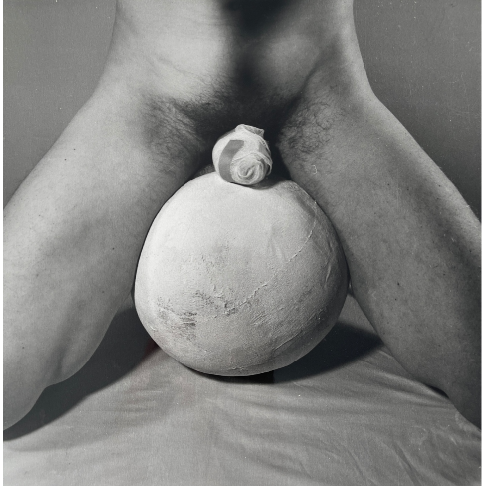 Rudorf Schwarzkogler, Aktion 2 [Δράση 2], Βιέννη, 1965-1966. Οι περισσότερες επιτελέσεις του Schwarzkogler, σε αντίθεση με εκείνες των υπόλοιπων μελών του κινήματος, είναι σκηνοθετημένες μπροστά στην κάμερα και δεν επιτελούνται ενώπιον κοινού. Ο καλλιτέχνης, κοντά στο πνεύμα του Günter Brus, ασχολείται στο έργο του κυρίως με τον ευνουχισμό και τον τραυματισμό, όπως ενδεικτικά φαίνεται στην φωτογραφία αυτή (που είναι μια από τις 58 ασπρόμαυρες φωτογραφίες της δεύτερής του δράση), όπου ένα ανδρικό μόριο είναι τυλιγμένο με επίδεσμο. Σε αντίθεση με τα υπόλοιπα μέλη του δραστισμού, ο Schwarzkogler δεν πρωταγωνιστεί ο ίδιος στις δράσεις του, και δεδομένου ότι οι φωτογραφίες ταυτίζονται με το έργο και δεν το τεκμηριώνουν απλά, καθώς το έργο αποτελεί φωτογραφική πρακτική κι όχι ζωντανή επιτέλεση/δράση ενώπιον κοινού, απομακρύνει το Schwarzkogler από το πνεύμα των υπόλοιπων μελών της ομάδας, που ήταν πιο κοντά στην λογική της ρευστότητας και της τυχαιότητας των χάπενινγκ του Φλούξους. 